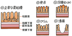 胃粘膜