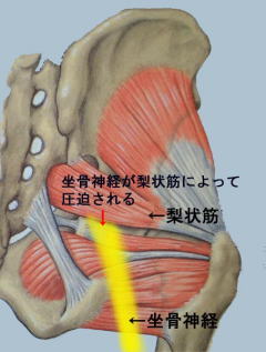 梨状筋