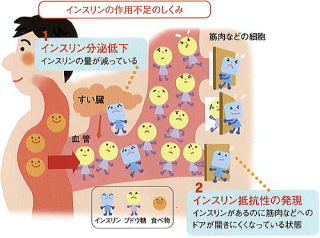 食べても空腹感がある症状について現代医学と中医学で解説 埼玉県川口市の石上鍼灸院