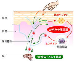 かゆみ